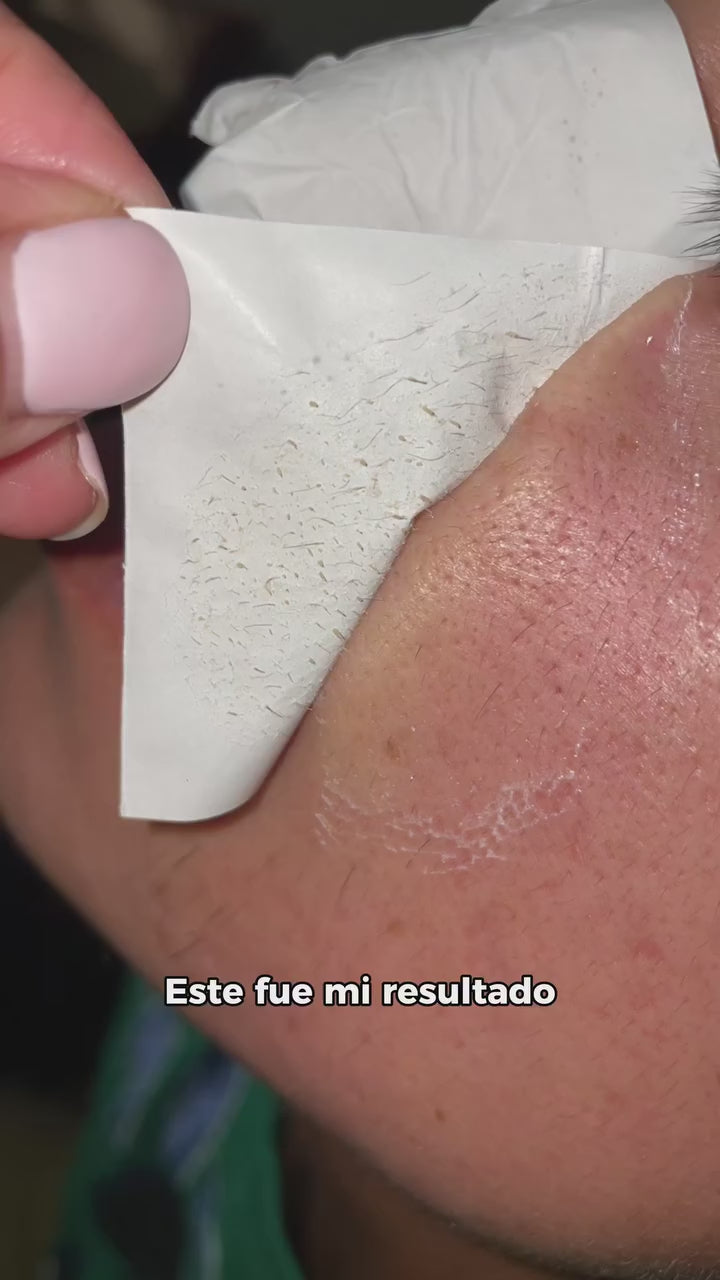Lanbena®: Mascarilla avanzada para puntos negros